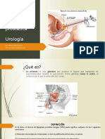 Hiperplasia prostática