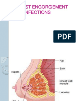 breastengorgement-130621100349-phpapp02.pdf