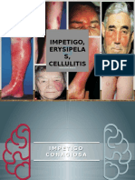 Impetigo, Erysipela S, Cellulitis: Rasay, Joana Mikee D