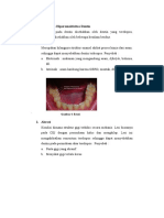 Faktor Penyebab Hipersensitivitas Dentin 