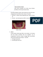 Faktor Penyebab Hipersensitivitas Dentin (38