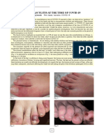 Nuova Vasculite Covid ENG PDF