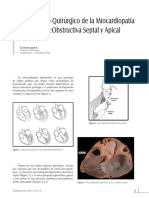 Tto Quirurgico Miocardiopahiper PDF