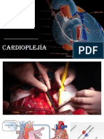 Cardioplejia