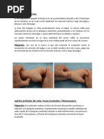 Tabaquera Anatómica
