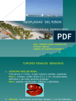 6. Tumores renales.ppt