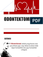 ODONTEKTOMI