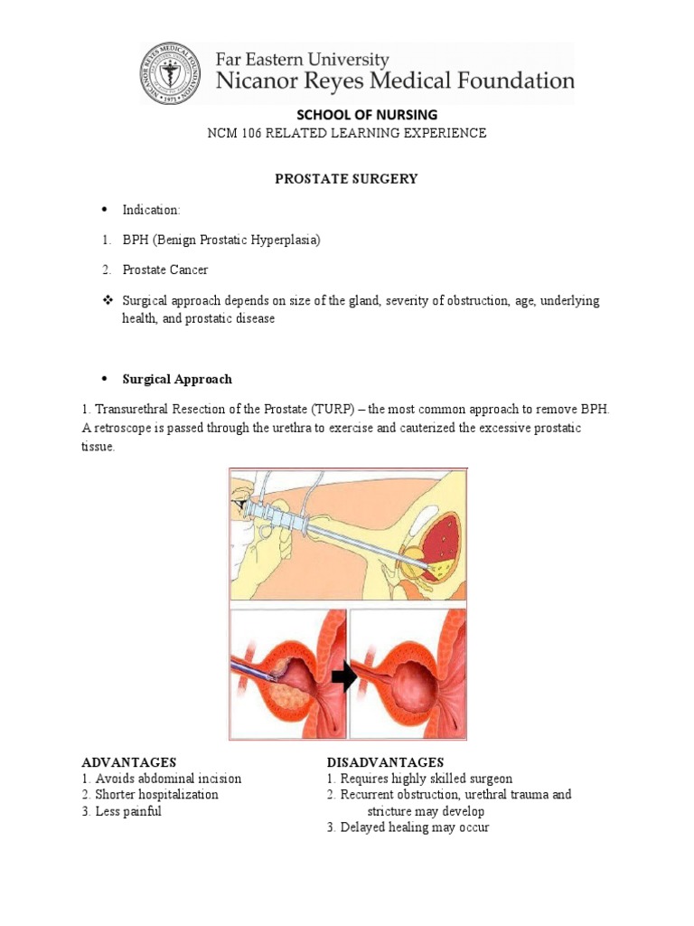 Repro System Notes | PDF | Urinary Incontinence | Mastectomy