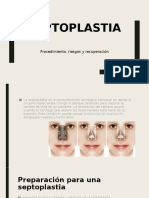 Septoplastia 2