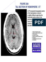 Head of Caudate Nucleus 2. Lateral Ventricle (Anterior Horn) 3. Third Ventricle 4. Lentiform Nucleus 5. Internal Capsule (Posterior Limb) 6. Thalamus 7. Quadrigeminal Plate Cistern 8. Cerebellum