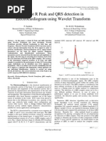 Download Robust R Peak and QRS Detection in Electrocardiogram Using Wavelet Transform by Editor IJACSA SN46132774 doc pdf