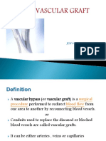 Types and Characteristics of Vascular Grafts