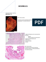 Informe N°4 PDF