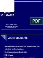 Akne Vulgaris, Rozase