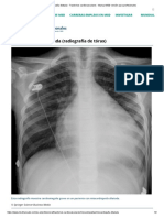 Miocardiopatía dilatada - Trastornos cardiovasculares - Manual MSD versión para profesionales.pdf