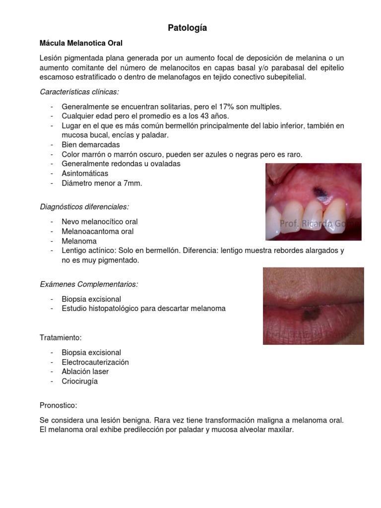 mcula melantica oral causas Oral: y Tratamiento | PDF | Medicina CLINICA Mcula Melantica Oral: Causas y