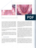 Ortodoncia en Dentición Mixta - Esgrivan_unlocked2 - 0550