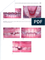 Ortodoncia en Dentición Mixta - Esgrivan - Unlocked2 - 0549 PDF