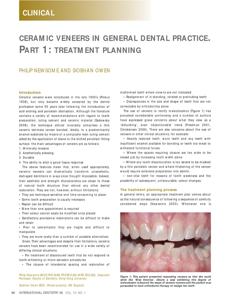 Ceramic Veneers in General Dental Practice | PDF | Dental Material ...