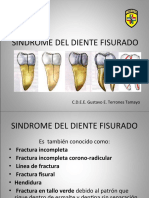 Sindrome Del Diente Fisurado