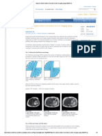 Tips For Robust Motion Correction in Liver Imaging Using Multivane