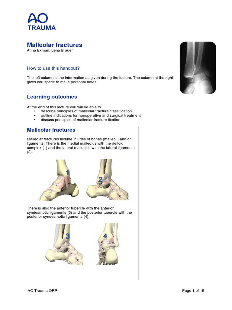 Malleolar Fracture Treatment Guide | PDF | Ankle | Anatomical Terms Of ...