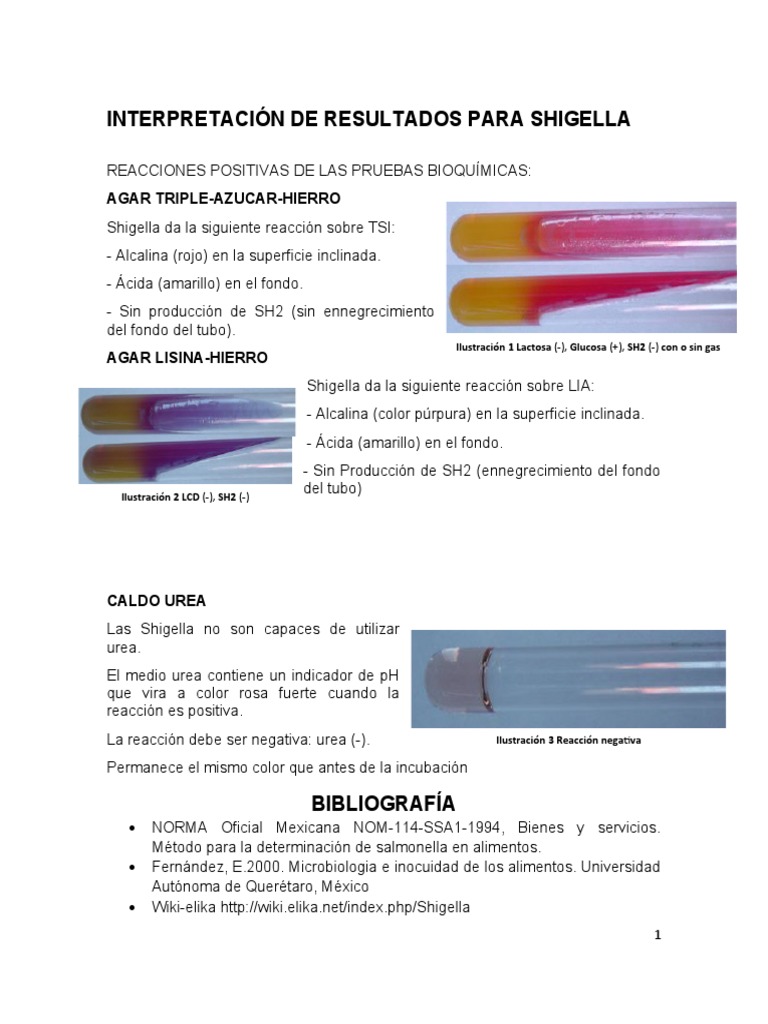 Interpretación de Resultados para Shigella | PDF