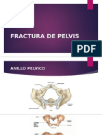 FRACTURA-DE-PELVIS exposicion.pptx