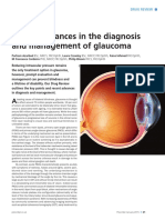 Recent Advances in The Diagnosis and Management of Glaucoma