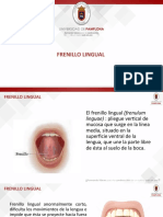 Frenillo lingual corto: causas, síntomas y tratamiento