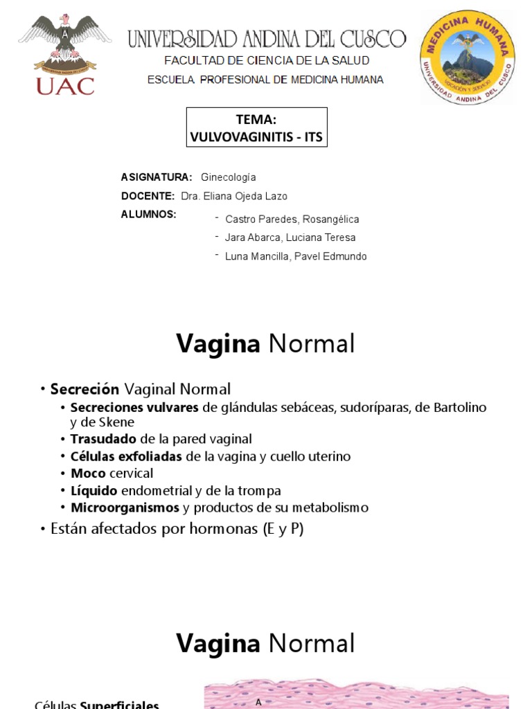 Vulvovaginitis Ets Teoria | PDF | Vagina | Infección transmitida ...
