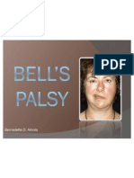 Bell’s palsy