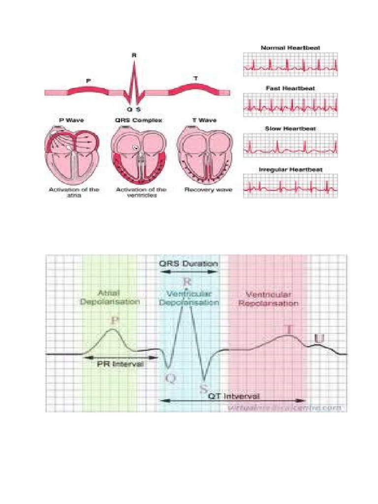 Understanding ECG Through Images | PDF | Teaching Methods & Materials