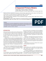 Submerged Primary Molars Case Report