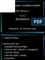 Epistaksis