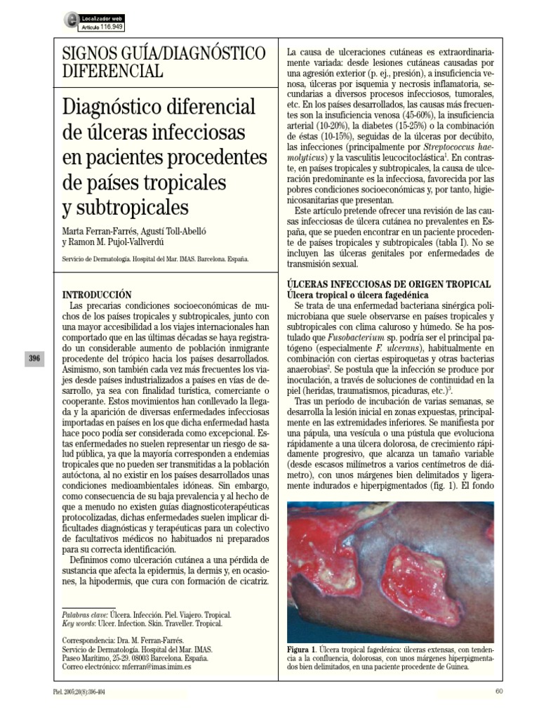 Ulcera Tropical PDF Medicina CLINICA Inmunología