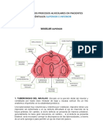 Partes de Los Procesos Alveolares en Pacientes Edentulo Superior e Inferior