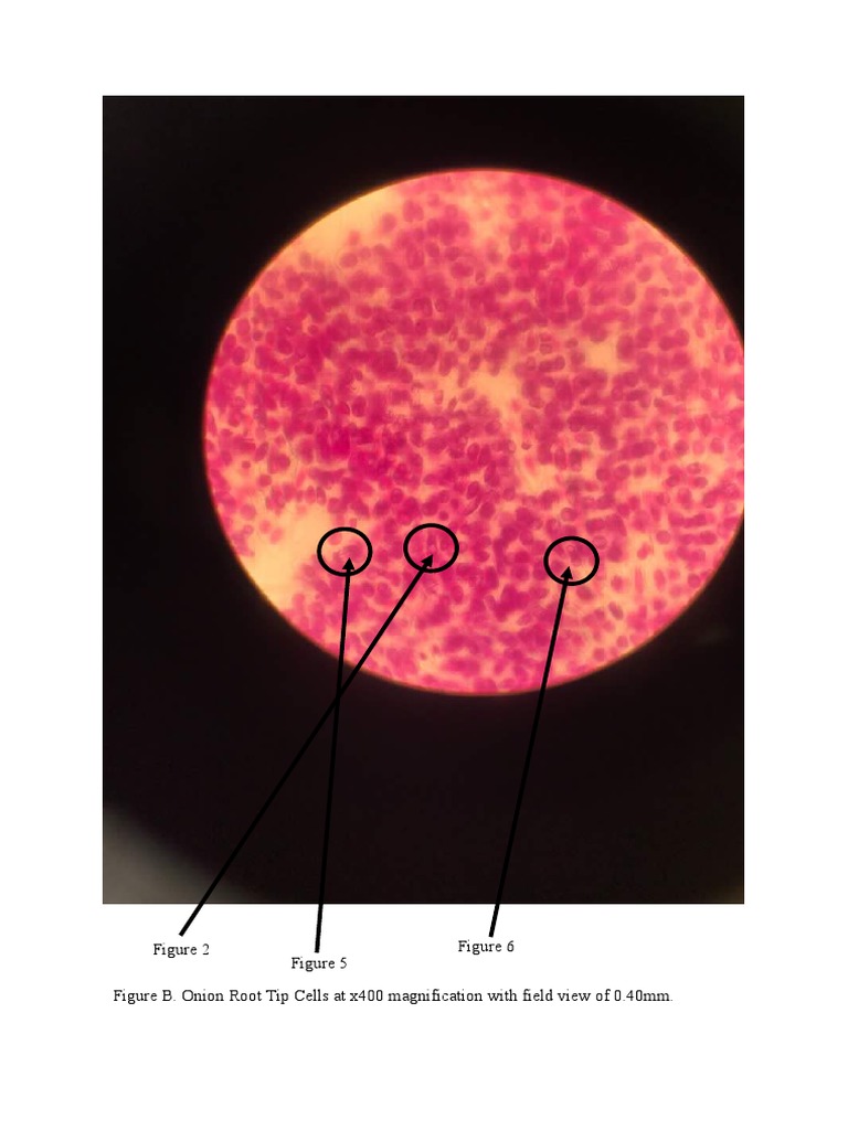 Figure B. Onion Root Tip Cells at x400 Magnification With Field View of
