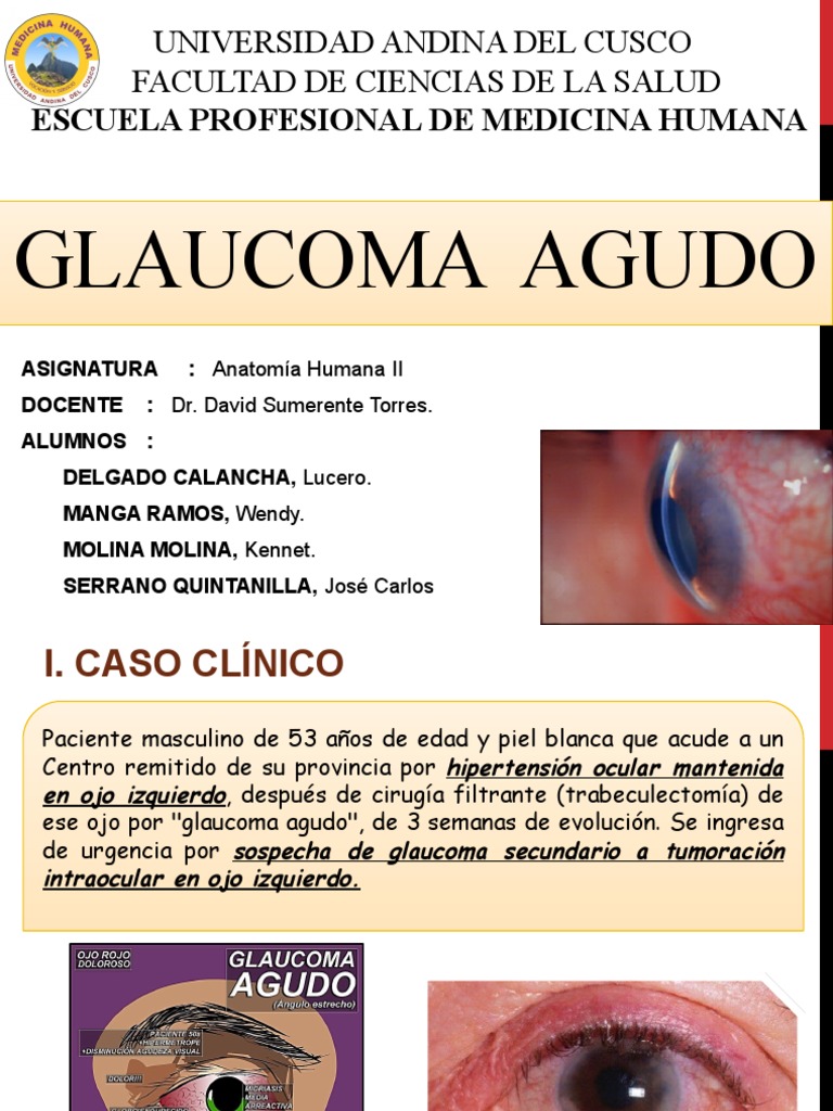 Glaucoma agudo y papila óptica | PDF | Glaucoma | Ojo humano