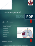 Derrame Pleural