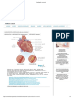 Cardiopatía Coronaria PDF