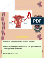 Miomatosis.pptx