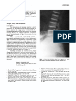 Arthritis & Rheumatism Volume 25 issue 8 1982 [doi 10.1002_art.1780250825] Bruce M. Rothschild -- “Rugger jersey” and osteopetrosis