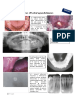 Atlas of Sailvary Gland Disease