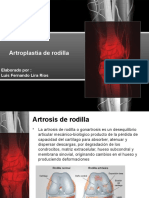 Artroplastia de Rodilla Historia Geriatrica