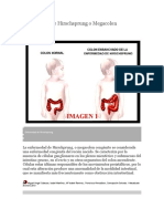 Enfermedad de Hirschsprung o Megacolon Agangliónico