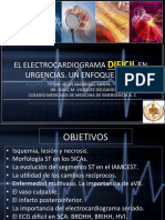 EKG DIFICIL EN SCA Nuevo PDF