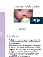 Cleft Lip and Palate