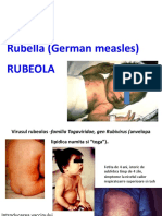 C5 Rubella Curs 5