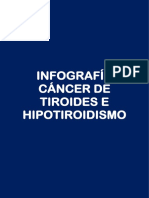 Cáncer de tiroides e hipotiroidismo: infografía